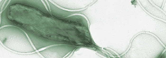 Stressosomes: Bacteria